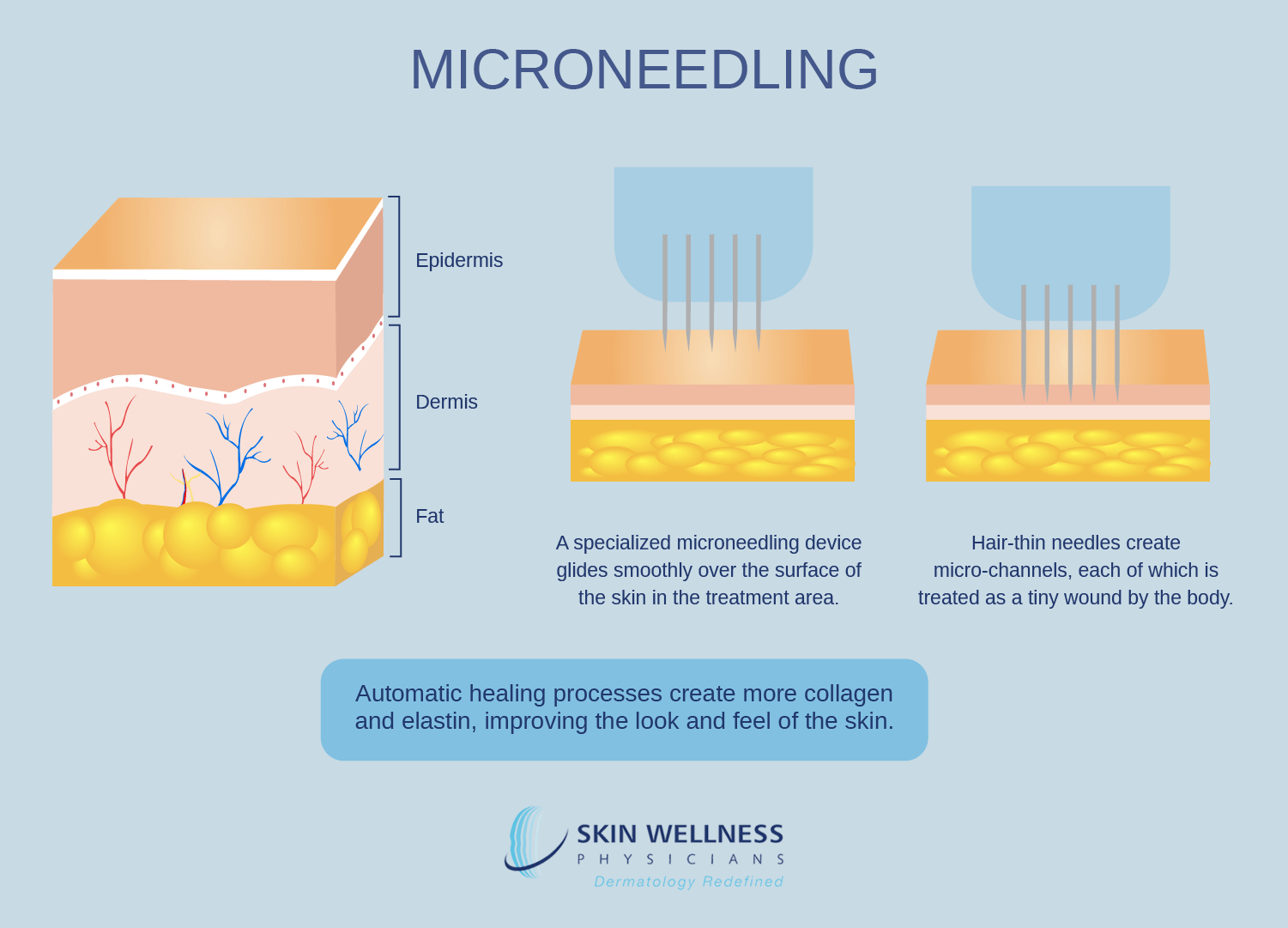 See how microneedling at Naples and Marco Island’s Skin Wellness Physicians works.
