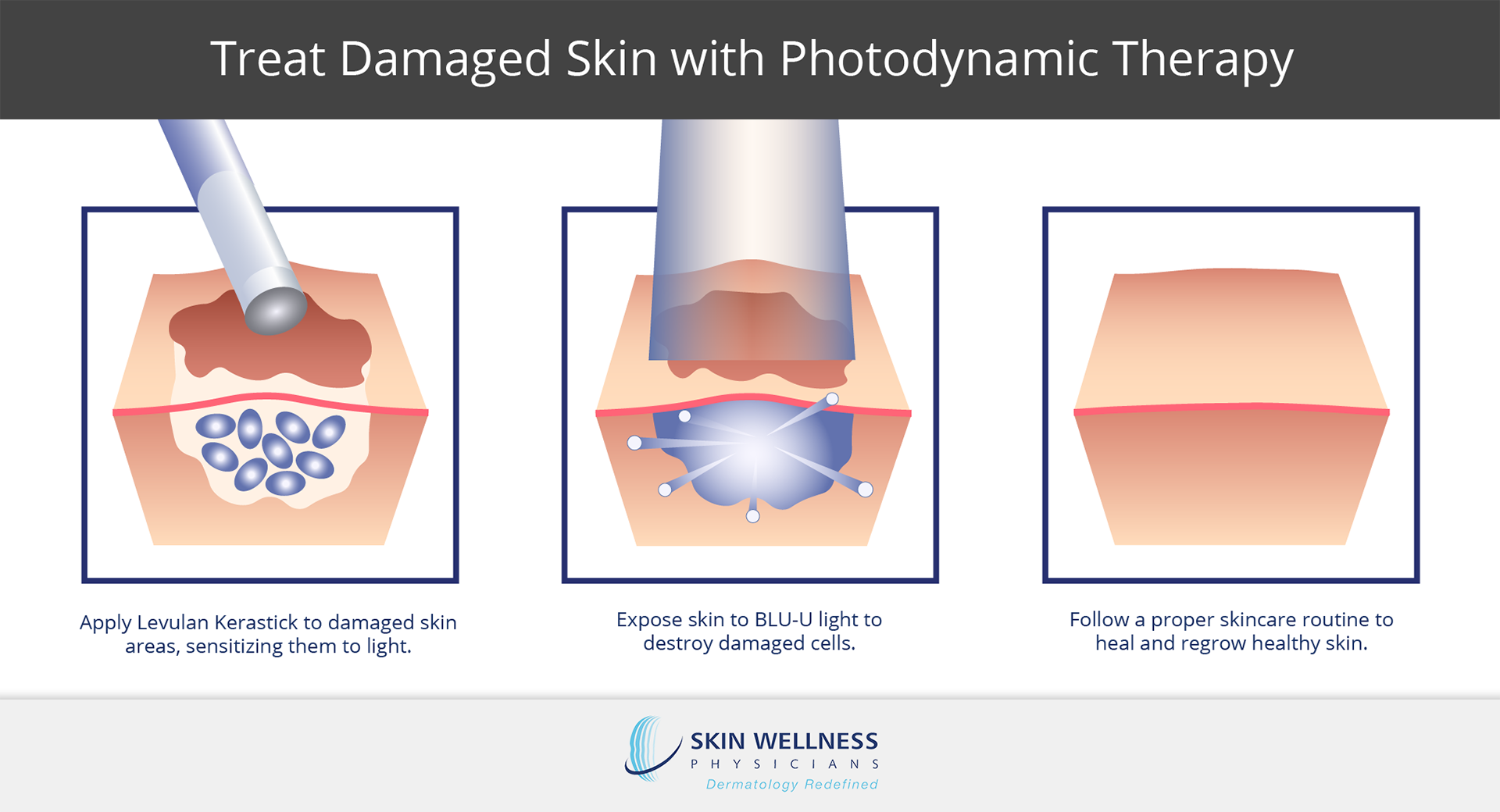 Learn the benefits of photofacial therapy at Florida’s Skin Wellness Physicians.